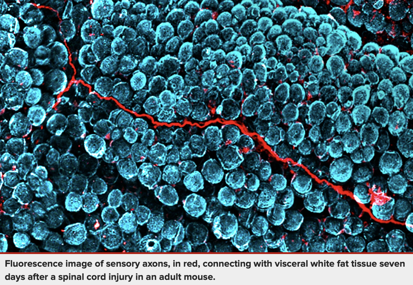Fluorescence image of sensory axons, in red, connecting with visceral white fat tissue seven days after a spinal cord injury in an adult mouse.
