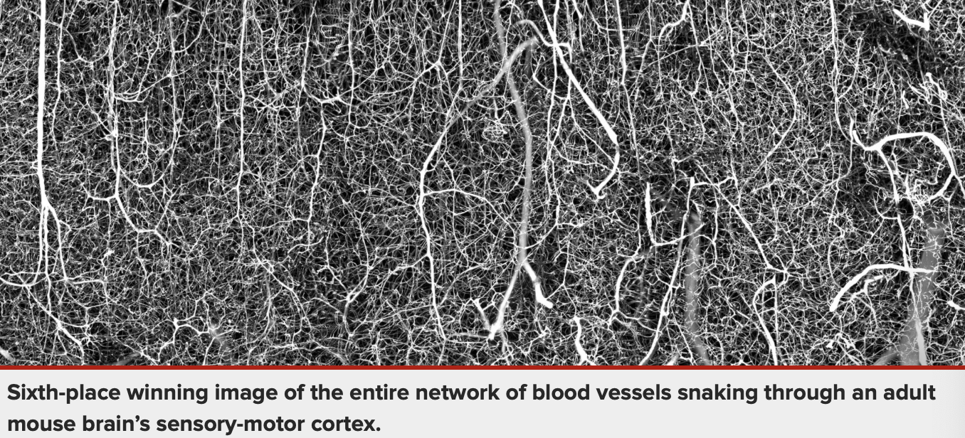 Sixth-place winning image of the entire network of blood vessels snaking through an adult mouse brain’s sensory-motor cortex.