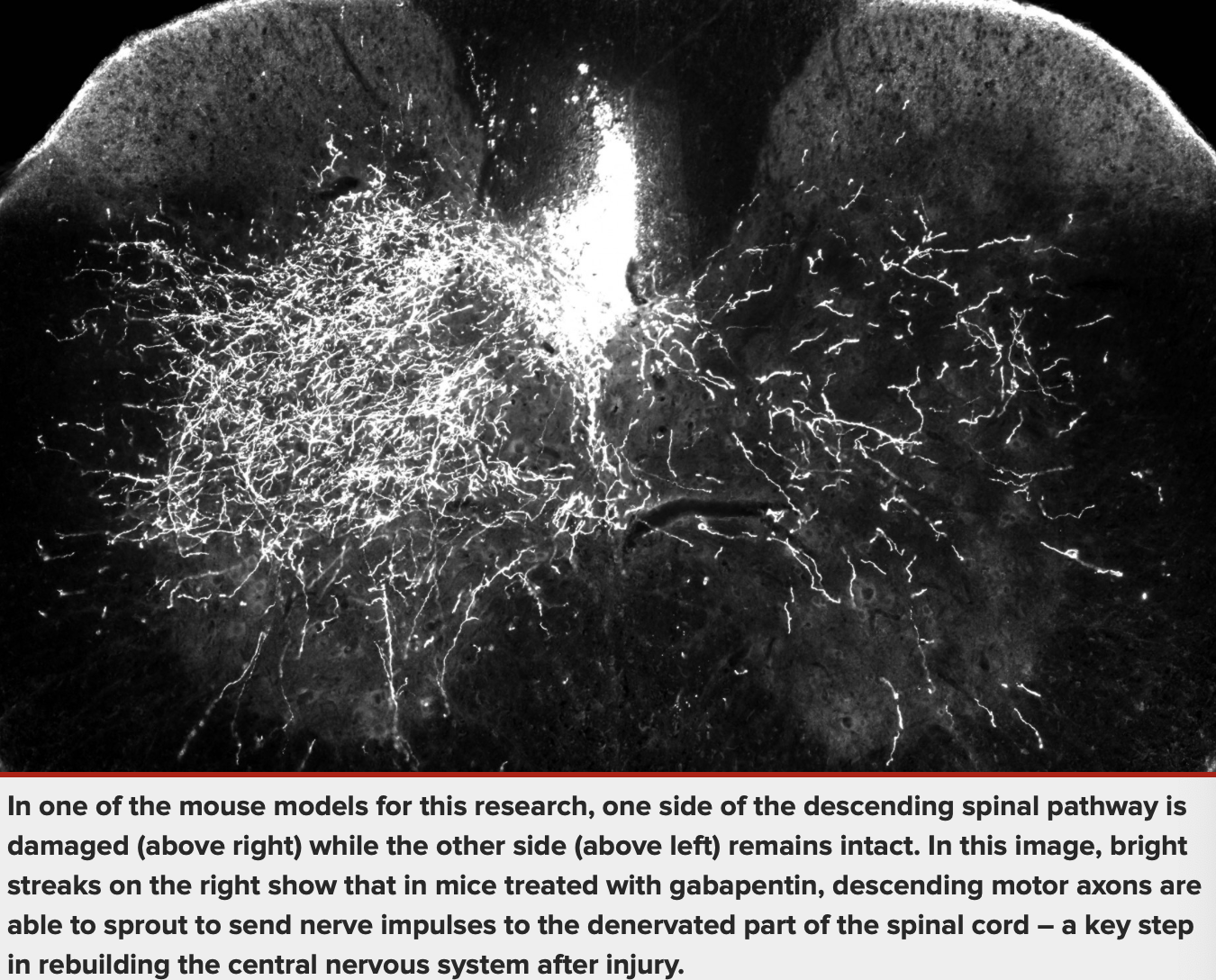 In one of the mouse models for this research, one side of the descending spinal pathway is damaged (above right) while the other side (above left) remains intact. In this image, bright streaks on the right show that in mice treated with gabapentin, descending motor axons are able to sprout to send nerve impulses to the denervated part of the spinal cord – a key step in rebuilding the central nervous system after injury.