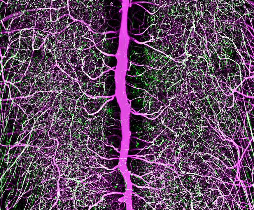 Tedeschi 2022 Image of the Year - colorized veins and arteries in a mouse brain